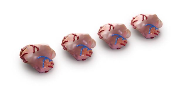 Stratasys J5 MediJet PolyJet 3D-Drucksystem